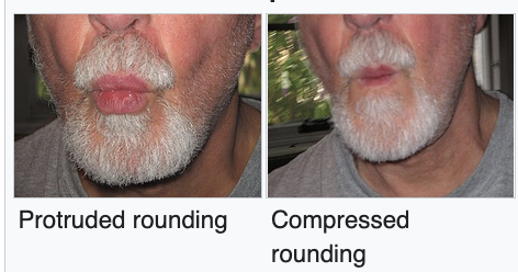 A picture showing how the lips are formed with protruded rounding vs compressed rounding
